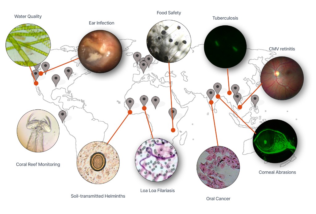 Global pilots: CellScope deployments and applications worldwide