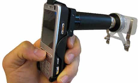 The original CellScope mobile-phone microscope attachment, from Breslauer et al., PLoS ONE (2009)