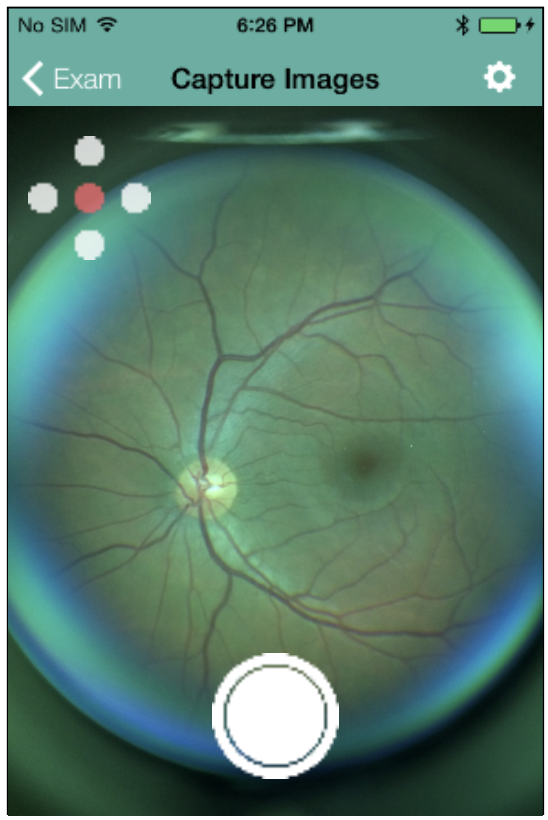 Ocular CellScope capture screen: live retinal preview with five-field fixation indicator and capture control