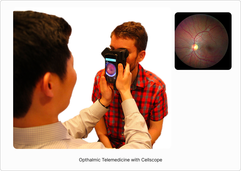 Ophthalmic telemedicine with CellScope
