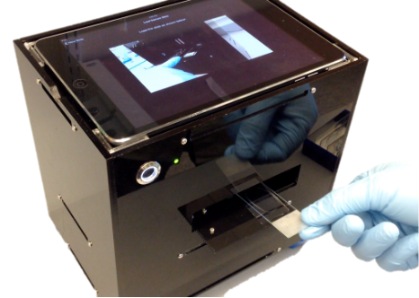 Automated TB Diagnostics