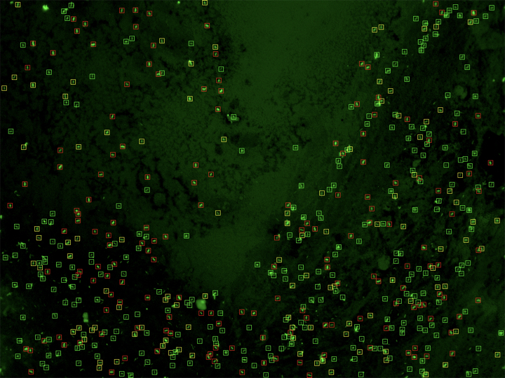 Fluorescence microscopy field at single-cell resolution, submicron detail, no overlays