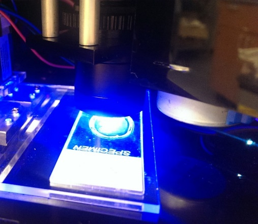 Blue-light excitation illuminating an auramine-stained slide during capture.