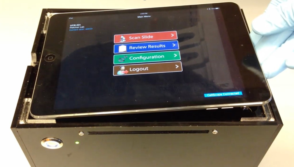 Gloved hand placing an iPad onto the TB CellScope base; main menu with Scan Slide, Review Results, and Configuration.